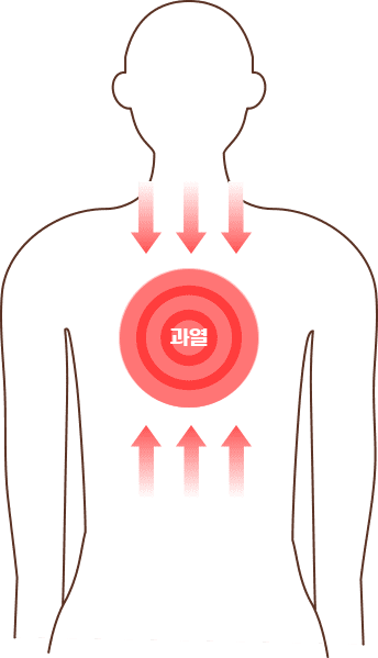 한 곳에 뭉친 열